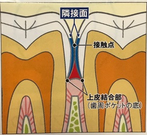 毎日のフロッシング習慣 医療法人さかの歯科 京都市西京区の歯医者ならさかの歯科