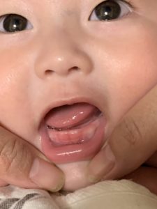 孫の乳歯