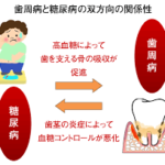 糖尿病と歯周病の関係