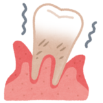 歯茎