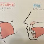 舌の位置の写真