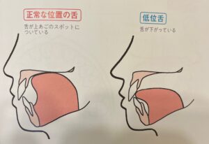 舌の位置の写真