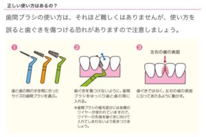 歯間ブラシ１
