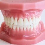 嚙み合わせの写真