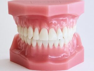 嚙み合わせの写真