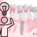 インプラント