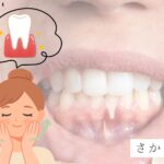 歯茎