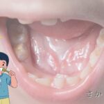 ６歳臼歯