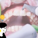 歯　クリーニング