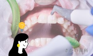 歯 クリーニング