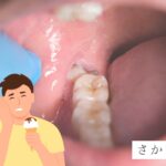 親知らず