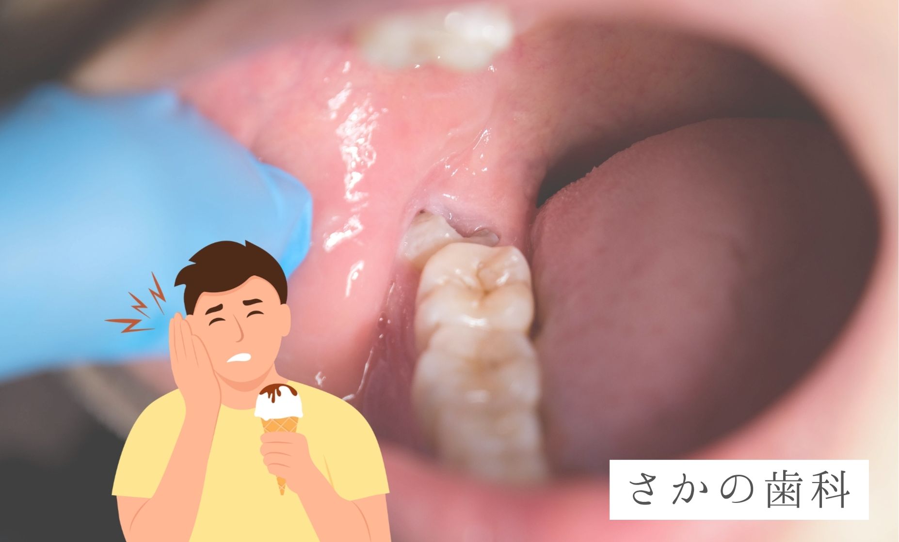 親知らず