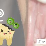 エナメル質形成不全