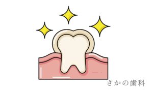 エナメル質形成不全